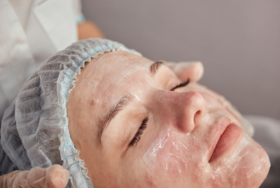 Acne Facials and Pore Cleansing Treatment in Washington | DC